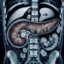 МРТ підшлункової залози